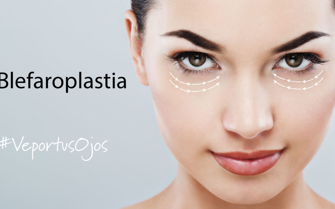 Blefaroplastia